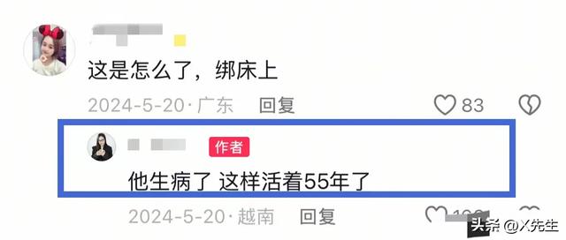 解脱了！越南“蝴蝶宝宝”去世，20多根绳子绑在床上，挂了50多年