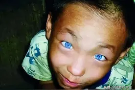 广西男童天生拥有蓝眼，夜晚视力依旧，检查后才发现原来是生病了图片