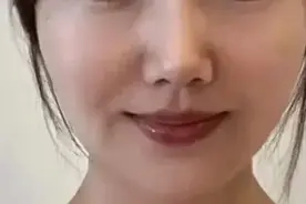 医院的医生和护士都很喜欢“脸部脂肪填充”这个医美项目！图片