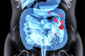 科学发现：55岁后补充4种益生菌，或可全面改善肠胃功能图片