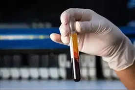 医生再三强调：高血脂变严重的5个表现，若有一个，也要及时就医图片