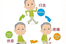 步行后下肢酸痛、休息缓解，当心间歇性跛行图片