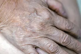 寿命长短从手背青筋看出？医生揭示：3个特征预示长寿图片