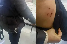 流浪猫8天抓伤3人！投喂它的好心女孩被告到法院，如今后续来了！图片