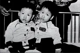 43年前成功分割的连体兄弟，弟弟娶娇妻生龙凤胎，哥哥却因病去世图片