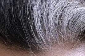寿命长不长，头发先知？70岁后，白发少的人活得久？告诉你答案！图片