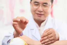 咳嗽的针灸治疗（详细分解）图片