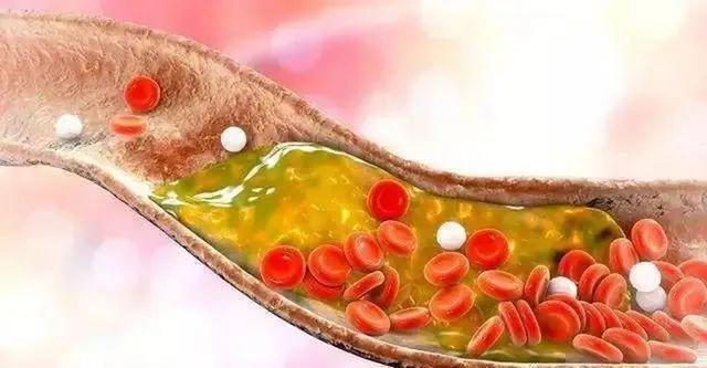 柿子受到关注！医生研究发现：常吃柿子的人，或会收获5大好处
