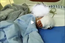 男童手臂伸进笼子被藏獒咬断图片