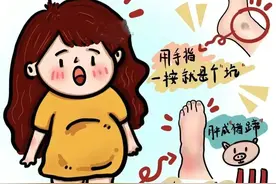 孕期水肿，“肿”么办？图片