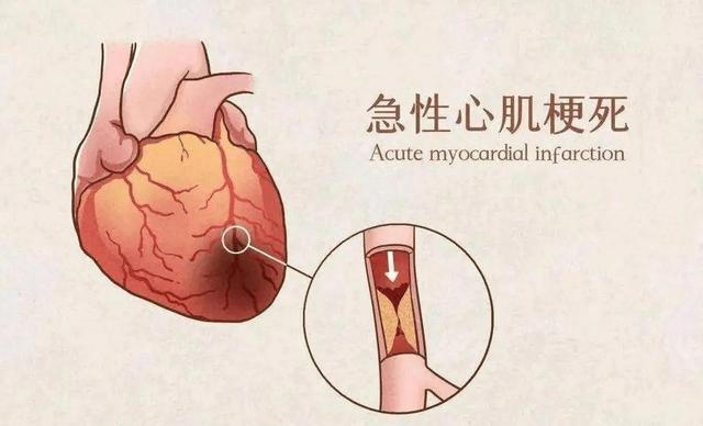 布洛芬能随便吃？研究发现：过量服用或长期用，3健康风险需警惕