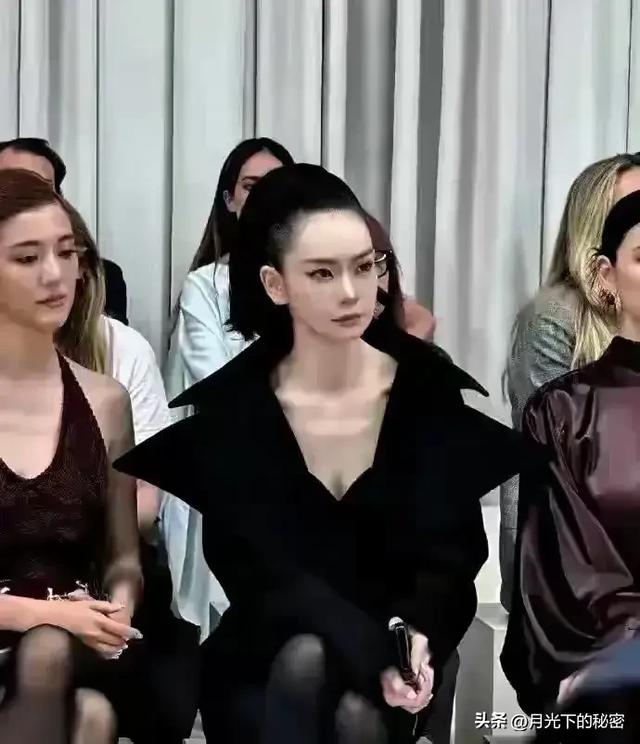 戚薇脸上做拉皮不疼吗？ 但一却为了美 这样拉的发际线后移好难看