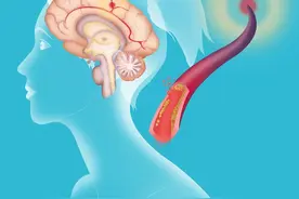 一碗三通汤，活血化瘀，通心、通脑、通血管，让全身都畅通无阻！图片