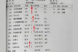 肝功能6项关键指标正常，说明你的肝脏基本健康！图片