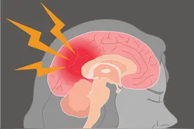 高血压性脑出血死亡率高达30%，出现5类症状，快去就医图片