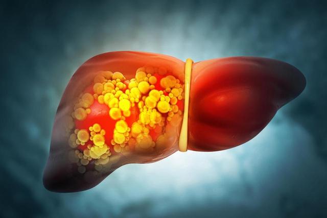 63岁男子皮肤瘙痒，以为是皮肤病	，体检后，医生叹：怎么不早来