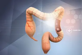 体验一次肠镜检查和息肉切除全程步骤图片