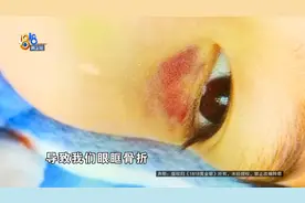 篮球课上头撞头，后果竟然这么重......图片