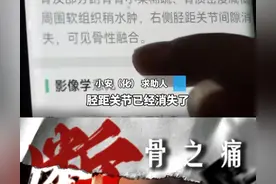 身高真的很重要吗？想要断骨增高吗？图片