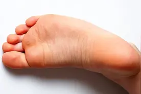 脚底板爱生茧子、走路疼痛是怎么回事？或是3种疾病在作祟图片