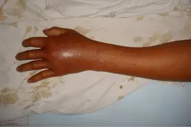 浙江最出名的毒蛇，毒性比眼镜王蛇还强，却被人称为最安全的蛇？图片