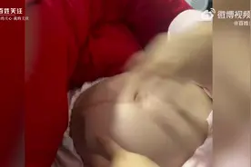 孕32周女子阻止丈夫刷礼物被踢肚致大块淤青，警方：已批评教育图片