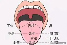 舌中有裂纹？千万别大意，可能与这4种情况有关图片
