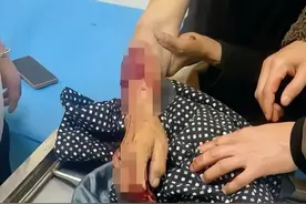 黄狗咬伤主人后续：狗已打死，爱狗人士失声！图片