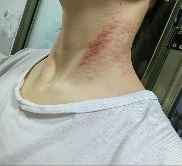 被家暴致死的女护士：一场隐秘的挣扎与系统性失灵