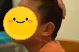 宝宝耳朵长这样是有福气？一篇文章看懂招风耳！图片