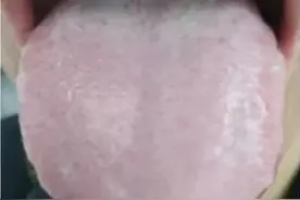 痰湿，寒湿，湿热 ，舌苔都很厚腻，今天教你一次看明白图片