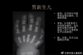 正常男、女生骨龄图谱，家长可对照观察图片