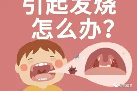 扁桃体发炎、咽喉痛艾灸哪个穴位，不吃抗生素，艾灸治愈扁桃体炎图片