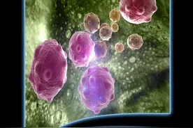 肿瘤不管多早期，做完手术多少都会有残留癌细胞吗？医生做出解释图片