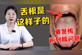 潘大夫舌诊：舌根是这样子的，要警惕前列腺问题了，阴部瘙痒图片