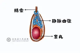 蛋蛋上长了“蚯蚓”？别慌！不开刀不留疤，拯救你“蛋蛋的忧伤”图片
