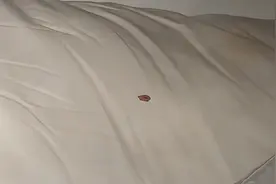 酒店里这些东西竟然这么脏？女人千万别碰！网友的经历太可怕！图片