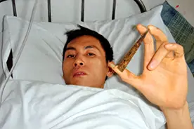 云南女子给丈夫按摩，导致丈夫吐血，检查发现头内有把10厘米匕首图片