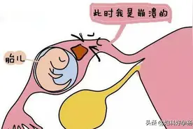 宫外孕后再备孕，到底做不做输卵管造影？如何预防？一篇讲透！图片
