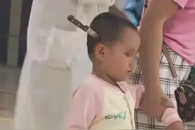 孩子不小心把把刀插进了脑袋，看看这位妈妈的正确做法图片