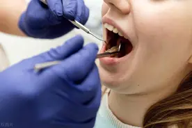 补牙能否走医保，2025年看牙报销政策如何？有哪些新政策，一起了解！图片