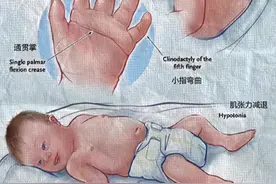 “唐” 字玩梗相关乱象：从对唐氏群体伤害到网络畸形秀！图片