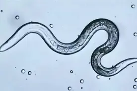 几十年前，人人肚子里几乎都有蛔虫，为何现在很少听说过了？图片