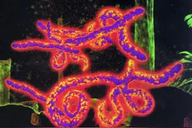 现实版的“丧尸病毒”，感染后人体即化为病毒喷泉，2天溶解内脏图片