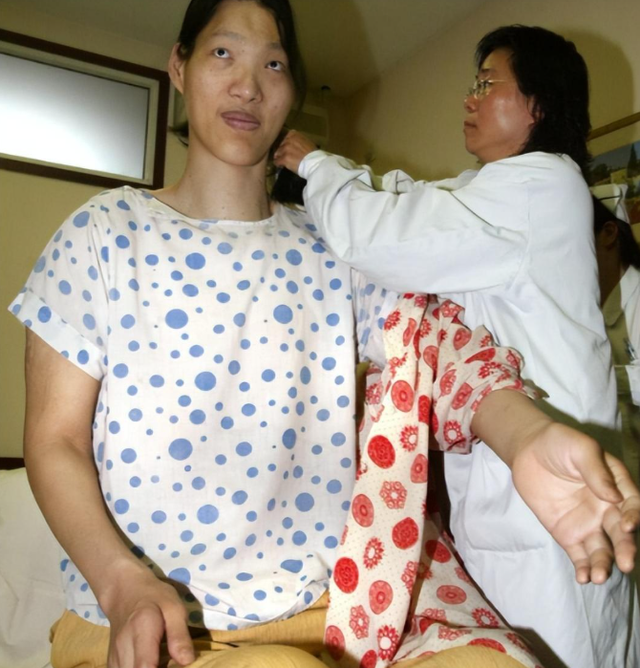 世界第一女巨人来自中国安徽，穿78码的鞋子，一顿饭吃六碗炒面