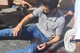 伊朗必须负责，真主党BP机是他们卖的，据说急需大量角膜和肾源！图片