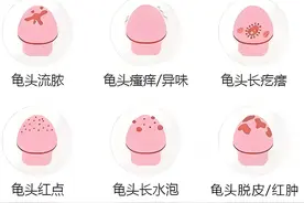 包皮炎是什么？如何预防呢？图片