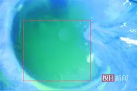 隐翅虫爬过眼睛，男子角膜瞬间灼伤受损，医生：这种虫子不能碰！图片