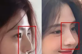 好直观…没人说吗？果然鼻子决定颜值的上限！ ​​​图片