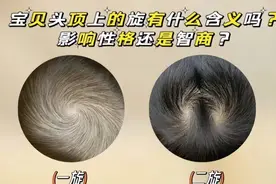 孩子聪不聪明，看头顶的“旋”就够了？很多父母不懂，看完涨知识图片